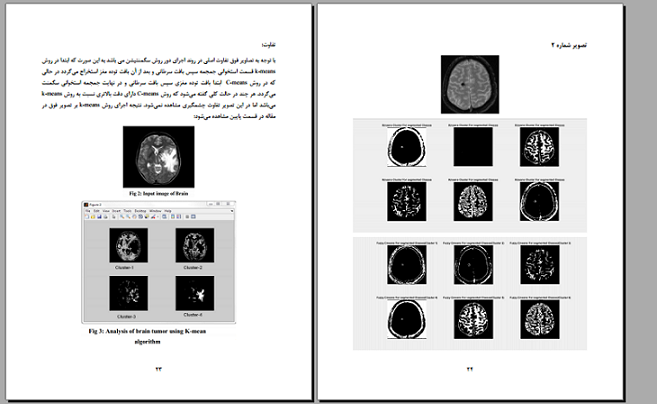 پروژه پردازش تصویر بررسی دو روش قطعه بندی (سگمنتیشن)  - ،C-means      وk-means - و تفاوتهای اجرای دو روش بروی تصاویر