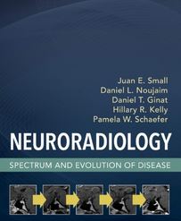 دانلود کتاب نورورادیولوژی طیف و تکامل بیماری Juan Small