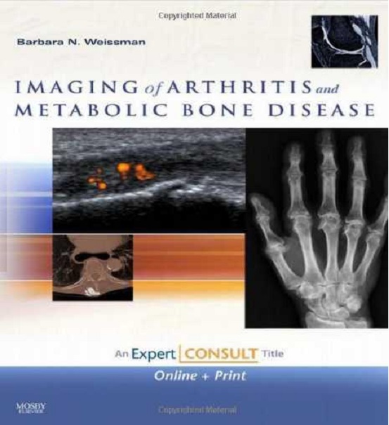 Imaging of Arthritis and Metabolic Bone Disease