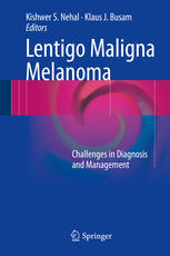 Lentigo Maligna Melanoma: Challenges in Diagnosis and Management