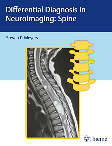 Differential diagnosis in neuroimaging. Spine