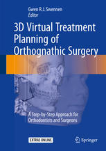 3D Virtual Treatment Planning of Orthognathic Surgery: A Step-by-Step Approach for Orthodontists and Surgeons