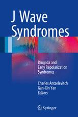 J Wave Syndromes: Brugada and Early Repolarization Syndromes