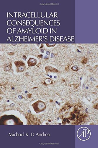 Intracellular Consequences of Amyloid in Alzheimers Disease