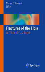 Fractures of the Tibia: A Clinical Casebook