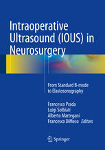 Intraoperative Ultrasound (IOUS) in Neurosurgery: From Standard B-mode to Elastosonography
