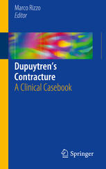 Dupuytren’s Contracture: A Clinical Casebook