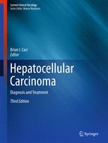 Hepatocellular Carcinoma: Diagnosis and Treatment