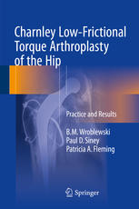 Charnley Low-Frictional Torque Arthroplasty of the Hip: Practice and Results