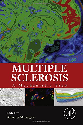 Multiple Sclerosis. A Mechanistic View
