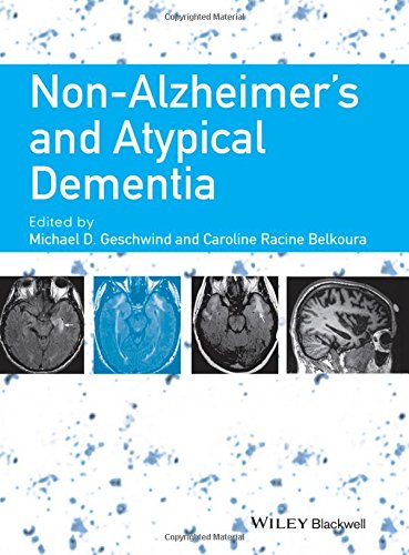 Non-Alzheimers and atypical dementia