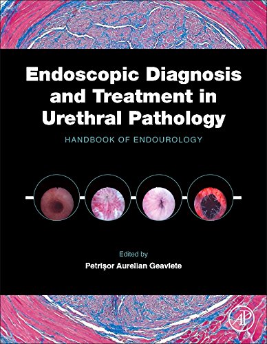 Endoscopic diagnosis and treatment in urethral pathology : handbook of endourology