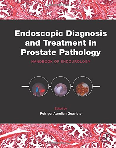 Endoscopic Diagnosis and Treatment in Prostate Pathology. Handbook of Endourology