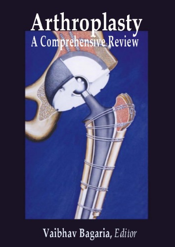 Arthroplasty A Comprehensive Review