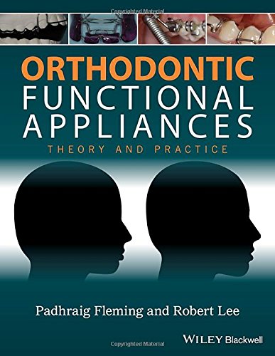 Orthodontic functional appliances: theory and practice