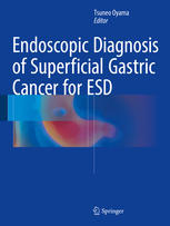 Endoscopic Diagnosis of Superficial Gastric Cancer for ESD