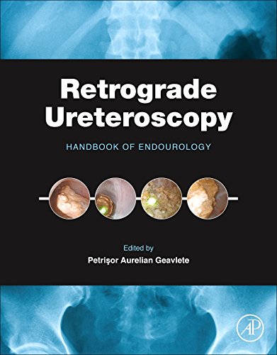 Retrograde Ureteroscopy. Handbook of Endourology