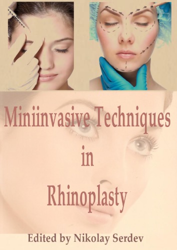 Miniinvasive Techniques in Rhinoplasty