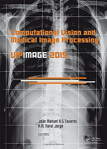 Computational Vision and Medical Image Processing V: Proceedings of the 5th Eccomas Thematic Conference on Computational Vision and Medical Image ...