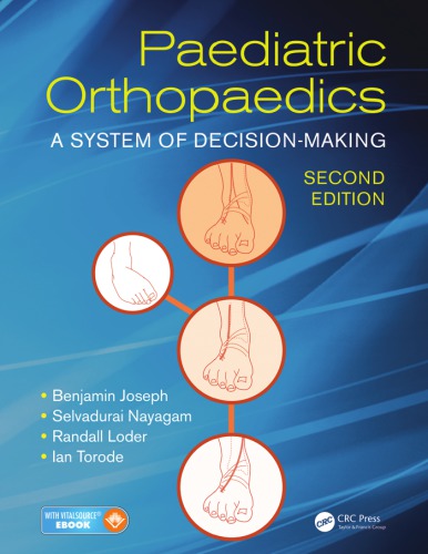 Paediatric orthopaedics : a system of decision-making