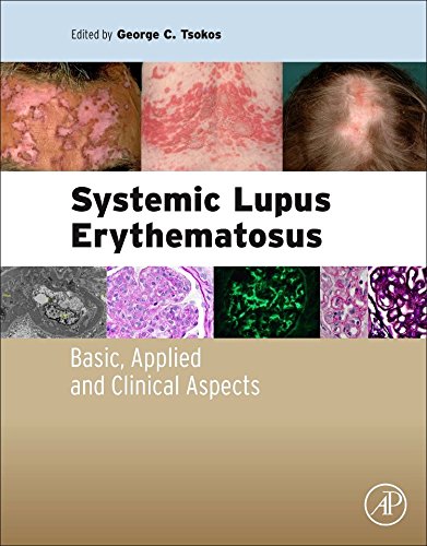 Systemic lupus erythematosus : basic, applied and clinical aspects
