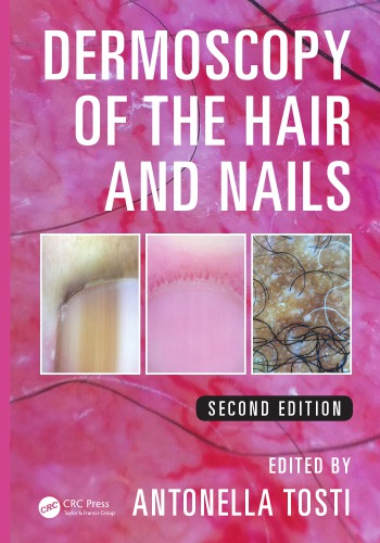 Dermoscopy of the hair and nails