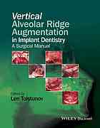Vertical alveolar ridge augmentation in implant dentistry : a surgical manual