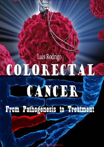 Colorectal Cancer From Pathogenesis to Treatment