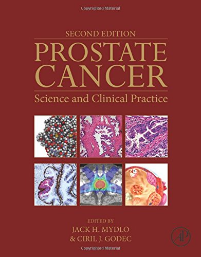 Prostate Cancer, Second Edition: Science and Clinical Practice