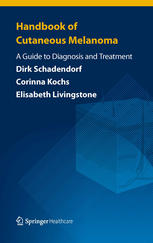 Handbook of Cutaneous Melanoma: A Guide to Diagnosis and Treatment