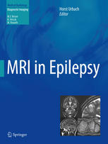 MRI in Epilepsy