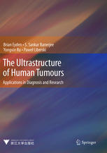 The Ultrastructure of Human Tumours: Applications in Diagnosis and Research
