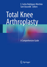 Total Knee Arthroplasty: A Comprehensive Guide