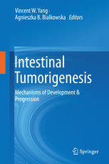 Intestinal Tumorigenesis: Mechanisms of Development & Progression