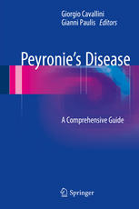 Peyronie’s Disease: A Comprehensive Guide
