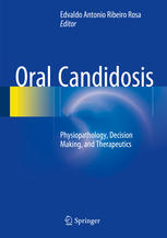 Oral Candidosis: Physiopathology, Decision Making, and Therapeutics
