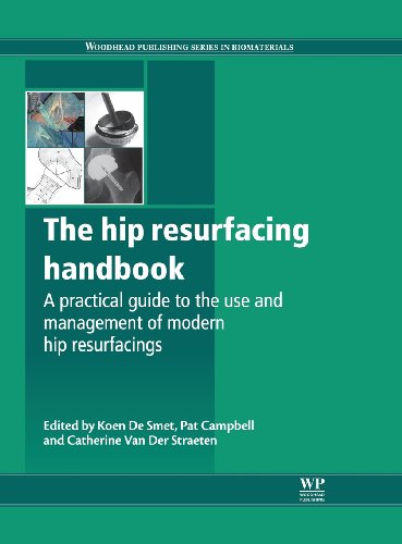 The hip resurfacing handbook: A practical guide to the use and management of modern hip resurfacings