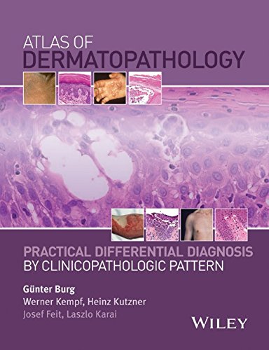 Atlas of dermatopathology : practical differential diagnosis by clinicopathologic pattern