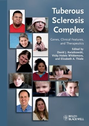 Tuberous Sclerosis Complex: Genes, Clinical Features and Therapeutics
