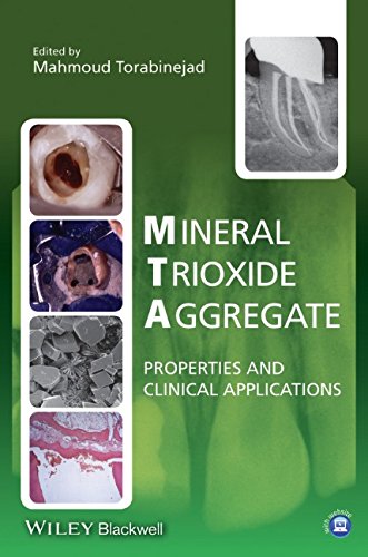 Mineral trioxide aggregate : properties and clinical applications