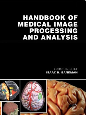 Handbook of Medical Image Processing and Analysis (2nd Edition)
