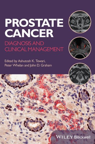 Prostate Cancer: Diagnosis and Clinical Management