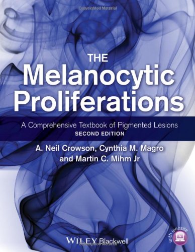 The Melanocytic Proliferations : a Comprehensive Textbook of Pigmented Lesions