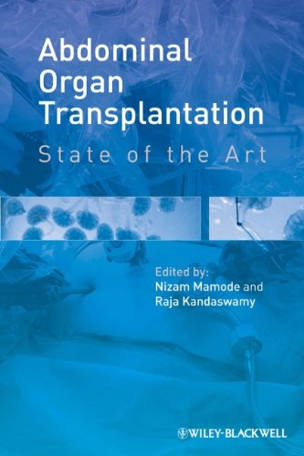 Abdominal Organ Transplantation: State of the Art
