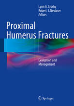 Proximal Humerus Fractures: Evaluation and Management