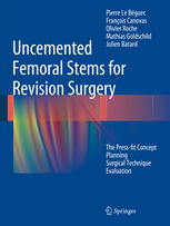 Uncemented Femoral Stems for Revision Surgery: The Press-fit Concept - Planning - Surgical Technique - Evaluation
