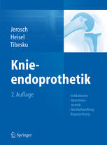 Knieendoprothetik: Indikationen, Operationstechnik, Nachbehandlung, Begutachtung