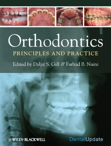 Orthodontics: Principles and Practice (Dental Update)