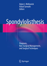 Spondylolisthesis: Diagnosis, Non-Surgical Management, and Surgical Techniques