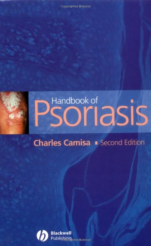 Handbook of Psoriasis 2nd Ed.